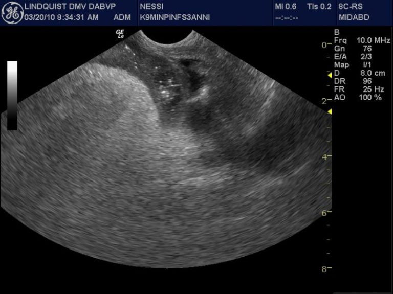 Intraoperative Ultrasound SonoPath