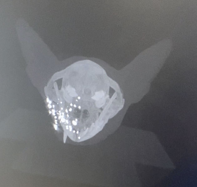 Large Subtentorial Extraaxial Intracranial Mass: our Case of the Month ...